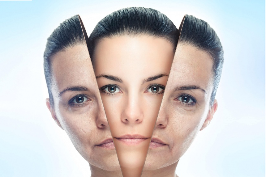 Tratamentul ridurilor faciale | Diantus Estet - Constanta